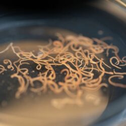 l'image représente des vers intestinaux