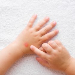 Come proteggere naturalmente il bambino dalle zanzare?