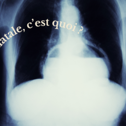 radio d'une hernie hiatale où l'on voit l'estomac remonter à travers le diaphragme