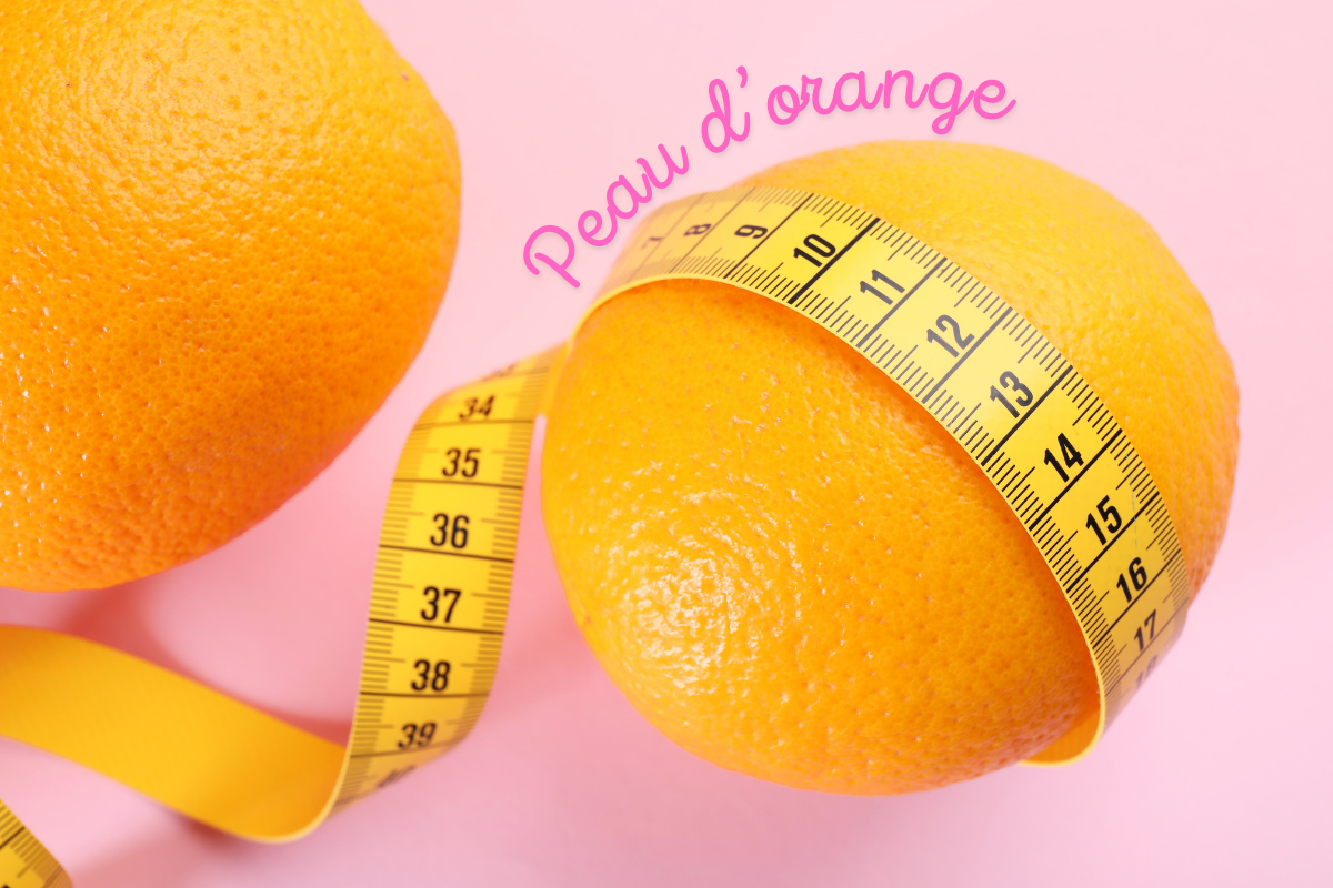 Deux oranges avec une peau texturée, entourées d’un mètre ruban sur fond rose, symbolisant l’apparence de la peau d’orange causée par la cellulite.