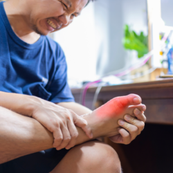 Un homme est assis, visiblement en détresse, tenant son pied gauche avec les deux mains. La partie supérieure du pied présente une rougeur marquée, suggérant une inflammation ou une douleur intense. Cette image peut illustrer des symptômes associés à des conditions comme la goutte, une inflammation due à l'excès d'acide urique dans le sang. L'expression du visage de l'homme transmet une souffrance aiguë, ce qui renforce l'idée que le pied est la source d'un grand inconfort. Le contexte domestique, avec un ordinateur portable en arrière-plan, indique que l'épisode douloureux a surgi dans un cadre quotidien, soulignant ainsi la perturbation soudaine que de telles conditions peuvent causer dans la vie de tous les jours