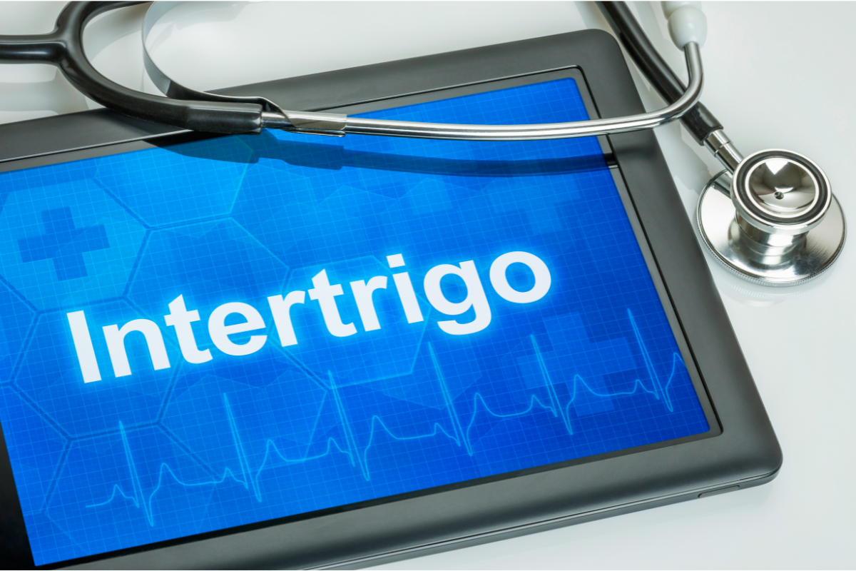 Comment prévenir l’intertrigo