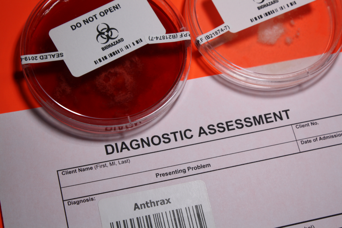résultat de diagnostique à l'anthrax