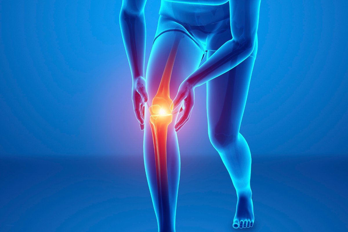 Illustration des douleurs articulaires mettant en évidence les zones inflammatoires du corps, représentant les principaux facteurs de risque de l’arthrose.