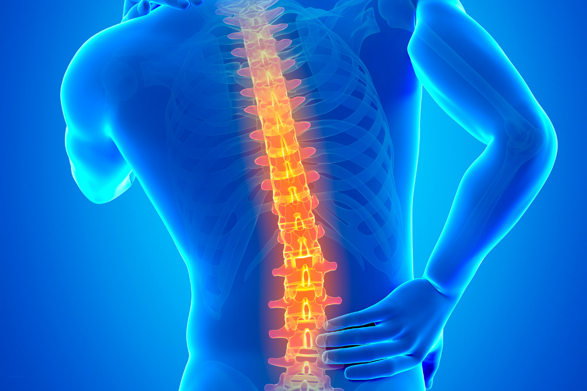 Illustration 3D d’une colonne vertébrale enflammée, représentant des douleurs dorsales et articulaires associées à des maladies comme l’arthrose et l’arthrite.