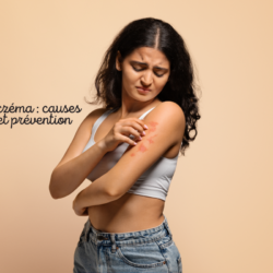 Femme qui se gratte le bras à cause de l’eczéma, illustrant les causes et la prévention de cette affection cutanée inflammatoire.