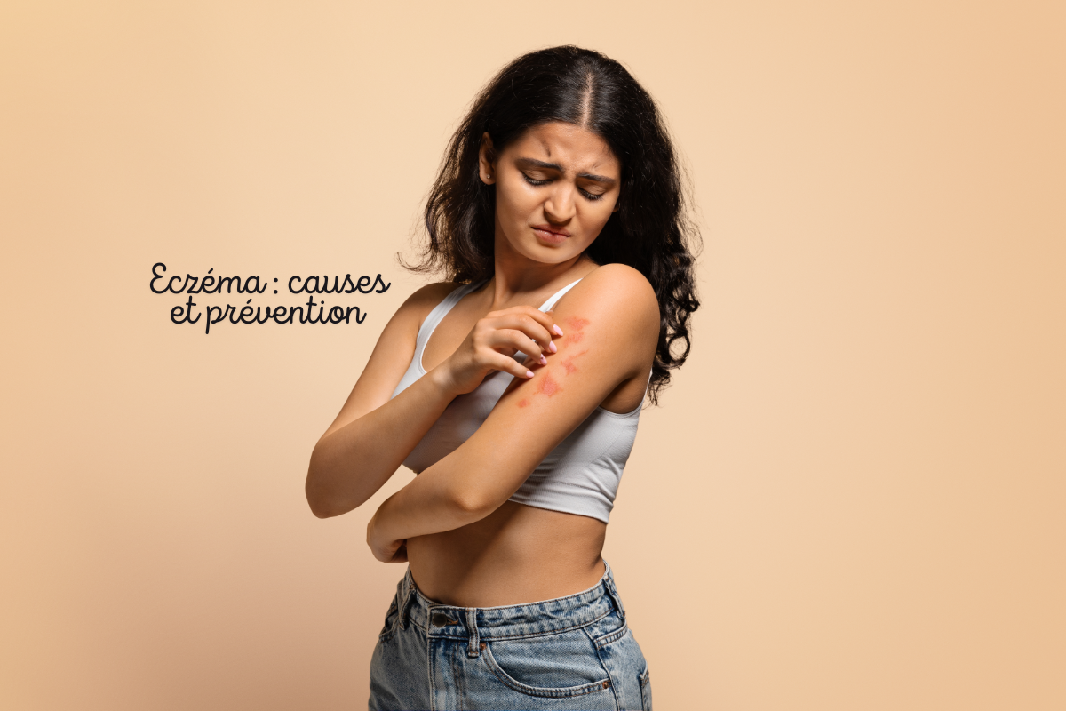 Femme qui se gratte le bras à cause de l’eczéma, illustrant les causes et la prévention de cette affection cutanée inflammatoire.